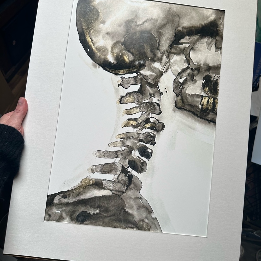 Cervical XRay Fine Art Print 13"x19" - Picture 3 of 3